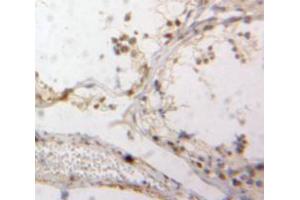 Used in DAB staining on fromalin fixed paraffin-embedded Testis tissue (DR1 antibody  (AA 2-170))
