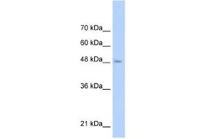 TLR6 antibody used at 1 ug/ml to detect target protein. (TLR6 antibody  (Middle Region))