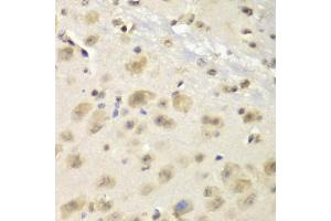 Immunohistochemistry of paraffin-embedded mouse brain using S100A10 antibody (ABIN5971035) at dilution of 1/100 (40x lens). (S100A10 antibody)