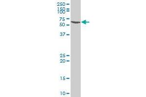 SMARCE1 polyclonal antibody (A01), Lot # 060529JCS1. (SMARCE1 antibody  (AA 75-142))
