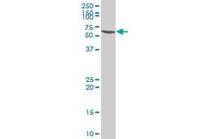 SMARCE1 polyclonal antibody (A01), Lot # 060529JCS1. (SMARCE1 antibody  (AA 75-142))