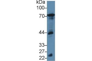 Detection of BLNK in Mouse Testis lysate using Polyclonal Antibody to B-Cell Linker Protein (BLNK) (B-Cell Linker antibody  (AA 65-314))