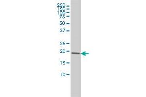 CETN3 monoclonal antibody (M01), clone 3E6 Western Blot analysis of CETN3 expression in Jurkat . (CETN3 antibody  (AA 1-100))