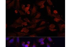 Immunofluorescence analysis of U2OS cells using GPER1 Polyclonal Antibody at dilution of 1:100. (Mesothelin antibody)