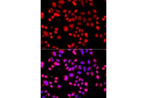 Immunofluorescence analysis of A549 cells using ASPSCR1 antibody (ABIN5975297). (ASPSCR1 antibody)