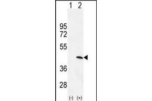 Western blot analysis of PRKAG1 (arrow) using rabbit polyclonal PRKAG1 Antibody (N-term) (ABIN655798 and ABIN2845227). (PRKAG1 antibody  (N-Term))