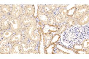 Detection of TNFRSF14 in Human Kidney Tissue using Polyclonal Antibody to Tumor Necrosis Factor Receptor Superfamily, Member 14 (TNFRSF14) (HVEM antibody  (AA 41-209))