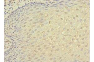 Immunohistochemistry of paraffin-embedded human tonsil tissue using ABIN7156472 at dilution of 1:100 (CD11c antibody  (AA 100-350))
