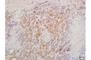 Formalin-fixed and paraffin embedded mouse lymphoma labeled with Rabbit Anti CRTAM Polyclonal Antibody, Unconjugated (ABIN1387894) at 1:200 followed by conjugation to the secondary antibody and DAB staining