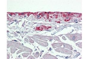 POSTN antibody was used for immunohistochemistry at a concentration of 4-8 ug/ml. (Periostin antibody  (N-Term))