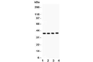 Western blot testing of IkB beta antibody and Lane 1:  mouse kidney (NFKBIB antibody  (AA 56-237))