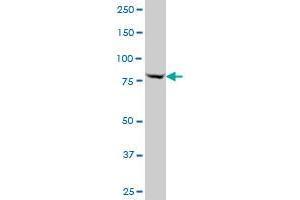 MYBL2 polyclonal antibody (A01), Lot # 051214JC01 Western Blot analysis of MYBL2 expression in A-431 . (MYBL2 antibody  (AA 601-700))
