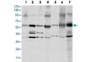 Western blot analysis of SRC monoclonal antobody, clone 1F11  against MCF-7 (1), A-431 (2), HeLa (3), HEK293 (4), NIH/3T3 (5), PC-12 (6) and COS-7 (7) cell lysate. (Src antibody)