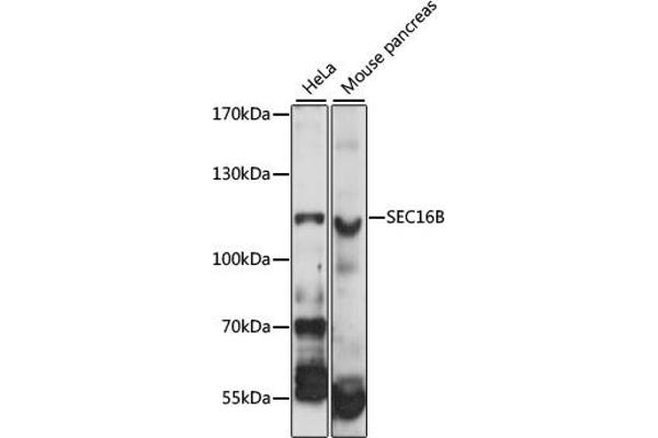 SEC16B anticorps  (AA 250-550)