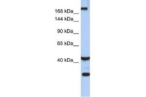 WB Suggested Anti-DISP1 Antibody Titration:  0. (DISP1 antibody  (Middle Region))