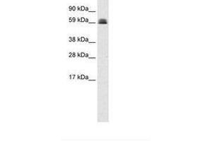 Image no. 1 for anti-Zinc Finger and BTB Domain Containing 45 (ZBTB45) (AA 253-302) antibody (ABIN6735949) (ZBTB45 antibody  (AA 253-302))