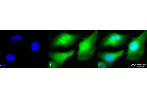 Immunocytochemistry/Immunofluorescence analysis using Rabbit Anti-AKT2 Polyclonal Antibody . (AKT2 antibody  (C-Term) (Biotin))