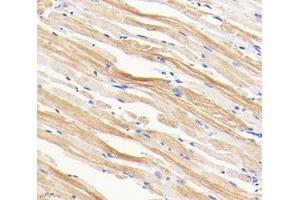 Immunohistochemistry analysis of paraffin-embedded mouse tongue using,TMP1 (ABIN7076030) at dilution of 1: 1600 (Tropomyosin antibody)