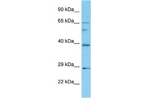 Western Blotting (WB) image for anti-Early Growth Response 2 (EGR2) (C-Term) antibody (ABIN2792631)