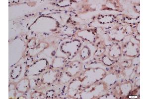 Formalin-fixed and paraffin embedded human kidney labeled with Anti-LMAN1 Polyclonal Antibody Polyclonal Antibody, Unconjugated  at 1:300 followed by conjugation to the secondary antibody and DAB staining. (LMAN1 antibody  (AA 31-130))