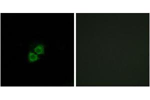 Immunofluorescence analysis of A549 cells, using AIBP antibody. (C1orf135 antibody)