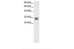 Image no. 3 for anti-HIV-1 Tat Interactive Protein 2, 30kDa (HTATIP2) (AA 30-79) antibody (ABIN202114) (HIV-1 Tat Interactive Protein 2, 30kDa (HTATIP2) (AA 30-79) antibody)