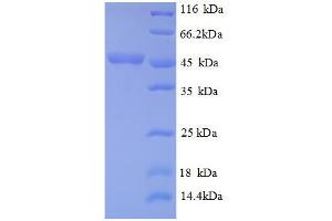 SDS-PAGE (SDS) image for Cystathionine beta-Lyase MetC (AA 1-392), (partial) protein (His tag) (ABIN1095562)