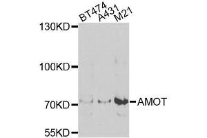 Western blot analysis of extracts of various cell lines, using AMOT antibody. (Angiomotin antibody  (AA 1-300))