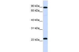 WB Suggested Anti-RGS19 Antibody Titration: 0. (RGS19 antibody  (N-Term))