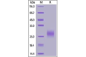 SDS-PAGE (SDS) image for Tumor Necrosis Factor Receptor Superfamily, Member 10b (TNFRSF10B) (AA 58-212) (Active) protein (His tag) (ABIN7013518)