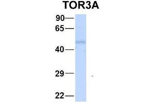 Host:  Rabbit  Target Name:  FAM46C  Sample Type:  Human Fetal Liver  Antibody Dilution:  1. (TOR3A antibody  (Middle Region))