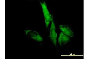 Immunofluorescence of purified MaxPab antibody to EIF3S5 on HeLa cell. (EIF3F antibody  (AA 1-357))