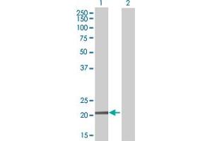 Western Blotting (WB) image for anti-TATA-Binding Protein-Associated Phosphoprotein (DR1) (AA 1-176) antibody (ABIN515068)