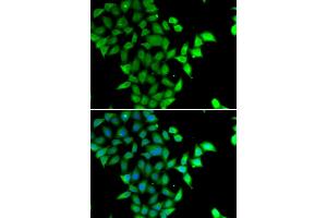 Immunofluorescence analysis of U2OS cells using STAM2 antibody.