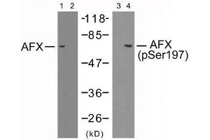 Western blot analysis of extracts from 293 cells using AFX (Ab-197) antibody (E021162, Lane 1 and 2) and AFX (phospho-Ser197) antibody (E011137, Lane 3 and 4). (FOXO4 antibody)