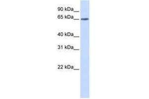 Image no. 1 for anti-YTH Domain Family, Member 3 (YTHDF3) (AA 108-157) antibody (ABIN6743846) (YTHDF3 antibody  (AA 108-157))