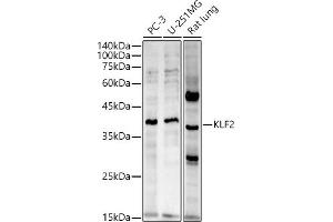 Western blot analysis of extracts of various cell lines, using KLF2 antibody (ABIN7268155) at 1:2720 dilution. (KLF2 antibody  (AA 50-150))