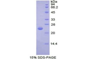 SDS-PAGE (SDS) image for Spectrin alpha Chain, Brain (SPTAN1) (AA 1004-1181) protein (His tag) (ABIN1877872) (SPTAN1 Protein (AA 1004-1181) (His tag))