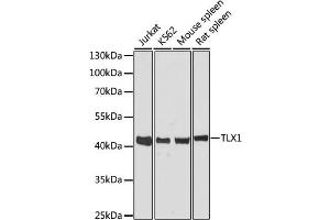 Western blot analysis of extracts of various cell lines, using TLX1 antibody. (TLX1 antibody)
