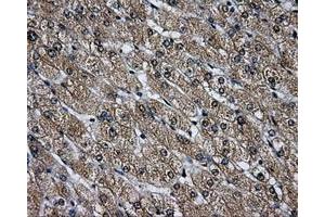 Immunohistochemical staining of paraffin-embedded Ovary tissue using anti-LOXmouse monoclonal antibody. (LOX antibody  (AA 22-168))