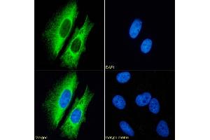 Immunofluorescence staining of fixed HeLa cells with anti-Cytokeratin 7 antibody OV-TL 12/30. (Recombinant Cytokeratin 7 antibody)