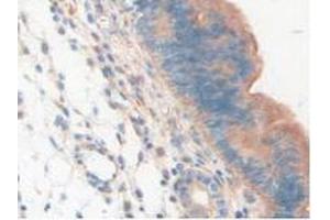 IHC-P analysis of Mouse Uterus Tissue, with DAB staining. (LAMP2 antibody  (AA 295-410))
