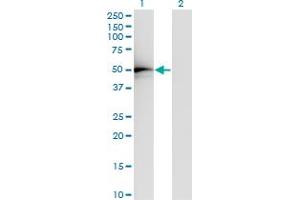 Western Blot analysis of TADA2L expression in transfected 293T cell line by TADA2L monoclonal antibody (M01), clone 4A8-1A7.