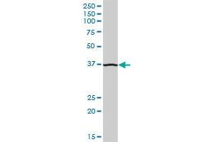 ADA MaxPab polyclonal antibody. (ADA antibody  (AA 1-363))