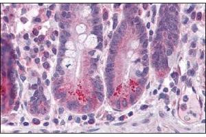 Immunohistochemistry of BRUCE in human small intestine tissue with BIRC6 Antibody  at 5 μg/ml.