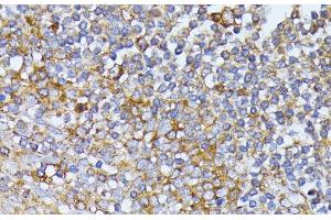 Immunohistochemistry of paraffin-embedded Human tonsil using EIF2B2 Polyclonal Antibody at dilution of 1:100 (40x lens).