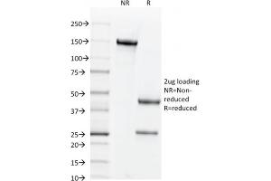 SDS-PAGE Analysis Purified CD44v6 Mouse Monoclonal Antibody (CD44V6/2496). (CD44 antibody)