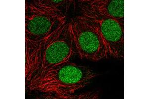 Immunofluorescent staining of MCF7 cells with PARP1 monoclonal antibody, clone CL2220  (Green) shows clear cycle dependent nuclear. (PARP1 antibody)
