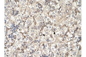 ST3GAL4 antibody was used for immunohistochemistry at a concentration of 4-8 ug/ml to stain Hepatocytes (arrows) in Human Liver.