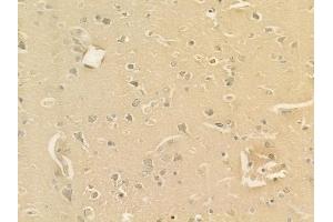 ABIN6262417 and ABIN6277679 at 1/100 staining human glioblastoma by IHC-P. (Serotonin Receptor 3A antibody  (Internal Region))